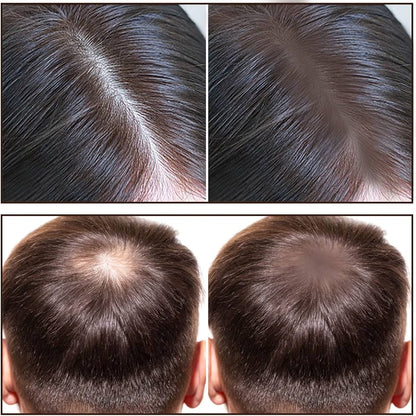 Hairline &amp; Eyebrow Powder