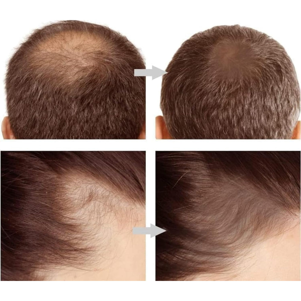 Hairline &amp; Eyebrow Powder